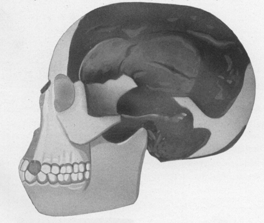 The Piltdown skull’s cranium was a clever forgery—modern human bone, probably medieval, stained with chemicals like iron solution and potassium dichromate to fake the look of ancient fossilization.