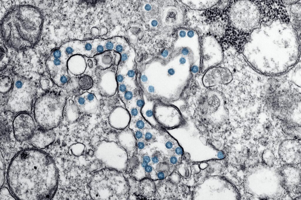 Microscopic Analysis