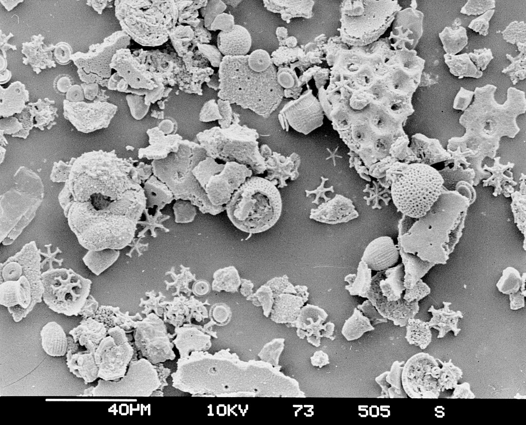 Microfossils from a sediment core of the Deep Sea Drilling Project