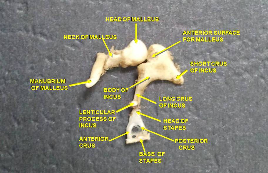 Labelled photograph of the Ossicles, the three bones of the middle ear. They are the malleus, the incus, and the stapes.
