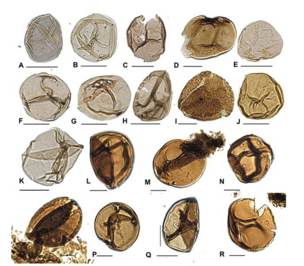 Close-up view of various pollen under a microscope, showcasing different shapes and textures. Each pollen grain shows unique linear patterns and brownish hues, indicating diversity in species.