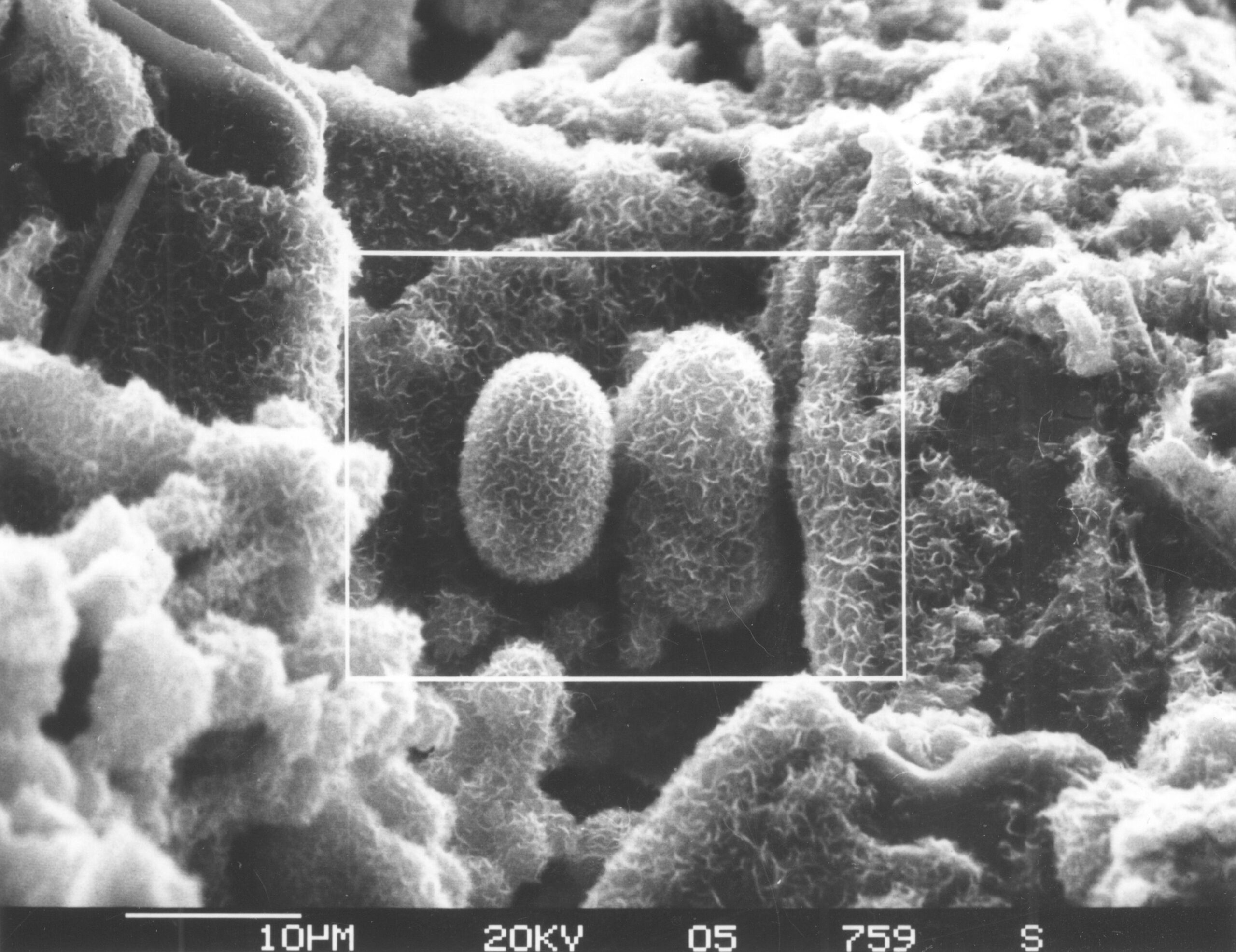Microscopic Marvels: Tiny Fossils with Big Stories (image credits: wikimedia)