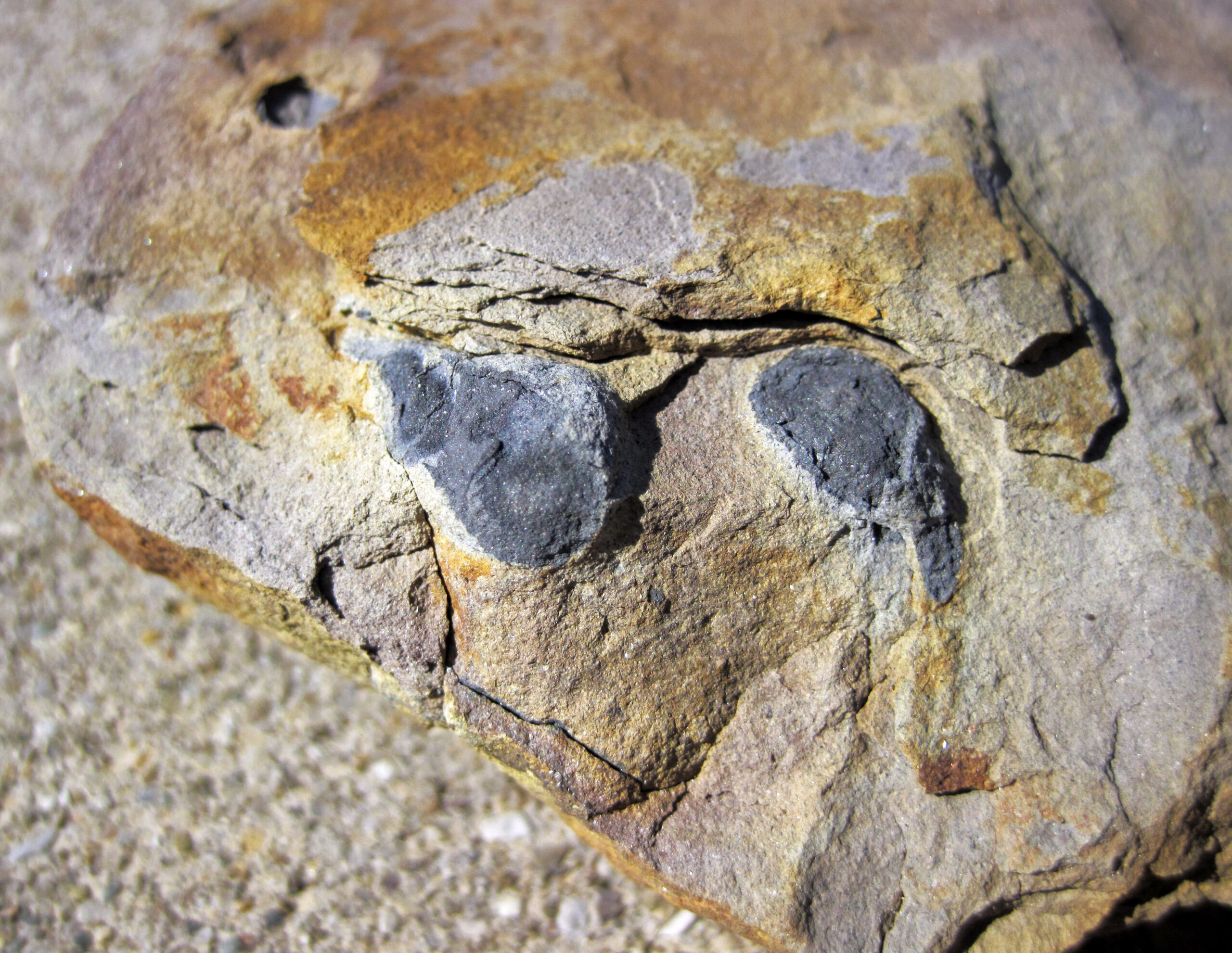 Bone Replacement by Metal (image credits: wikimedia)