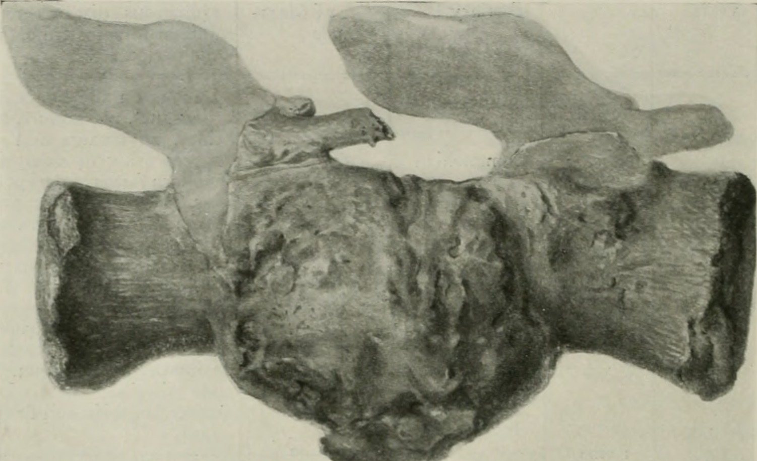 Evidence of Starvation and Disease (image credits: wikimedia)