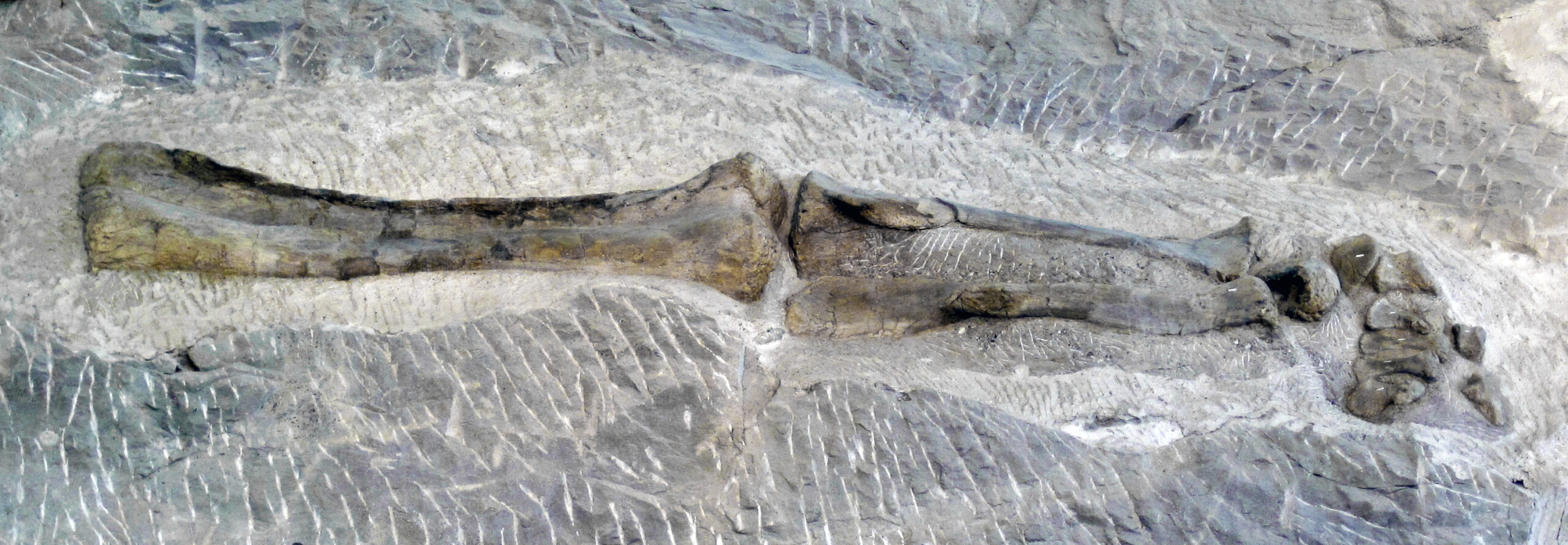 Stress Fractures and the Active Life (Image Credits: Wikimedia)