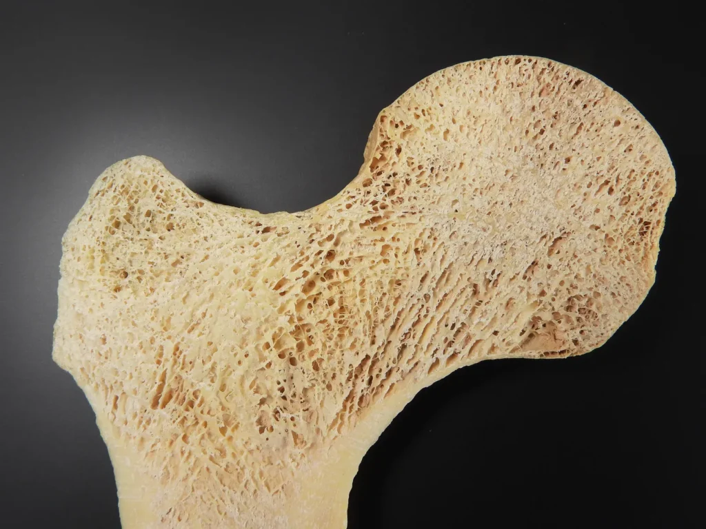 Tiny Bump on 7 Million-Year-Old Fossil Suggests Ancient Ape Walked Upright - and Might Even Be a Human Ancestor