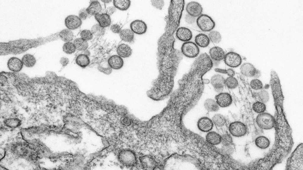 Active and passive membrane exchange reshape how cell surface clusters grow, study finds
