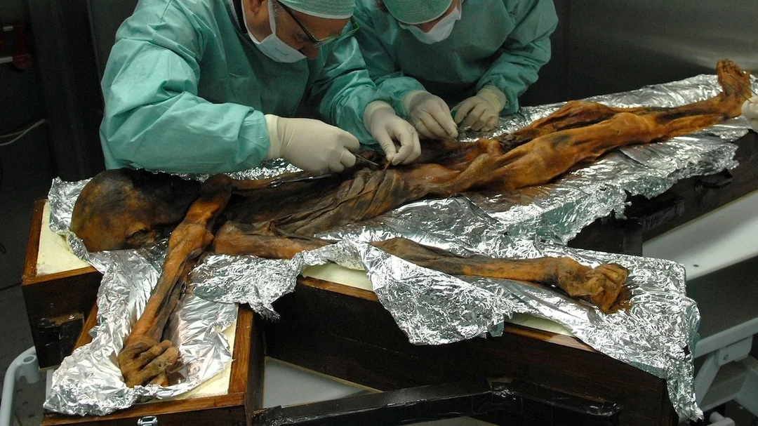DNA, Diet, and the Last Meal Before Death