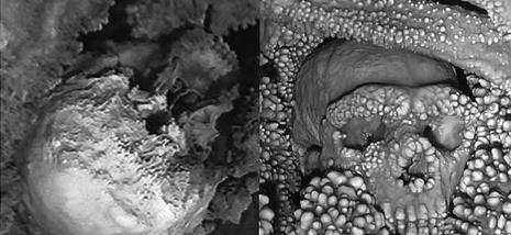 4. The Altamura Neanderthal: A Farmer’s Cave Turns Into a Time Capsule 