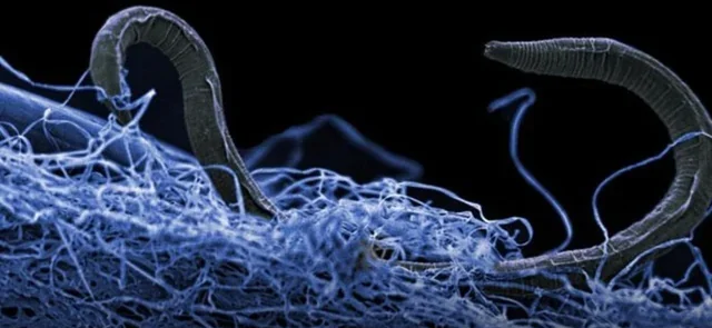 7. Zombie Worms That Eat Bones Without Mouths or Stomachs 