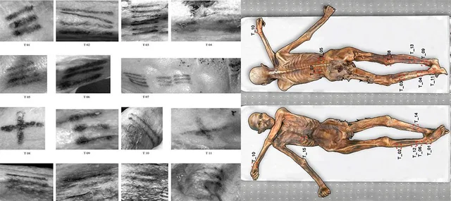 2. His Tattoos May Be a Kind of Prehistoric Acupuncture 