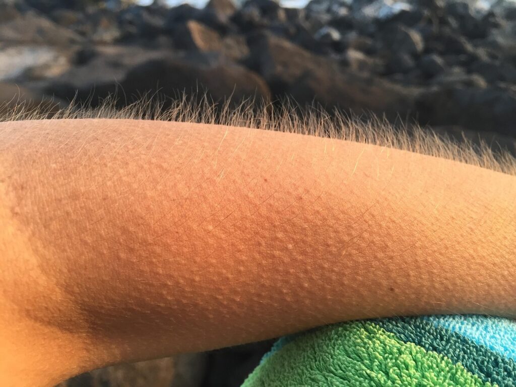 Evolutionary Biology Says Human Goosebumps Are a Relic From Hairier Ancestors