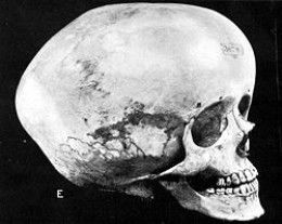 #12 - The Boskop Skulls That Sparked a "Big-Brained Race" Panic