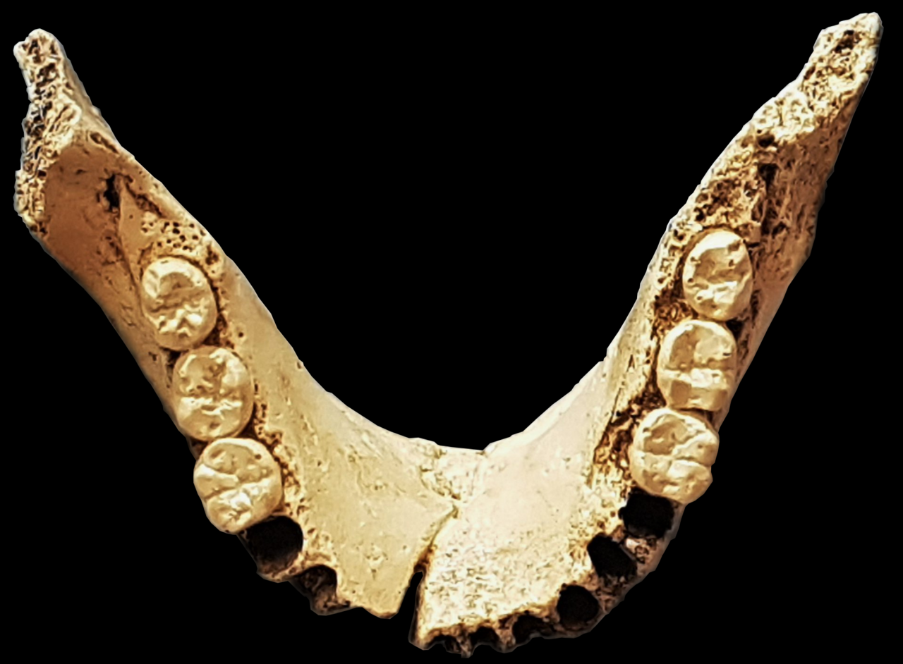 #8 - The First Human Teeth That Started It All