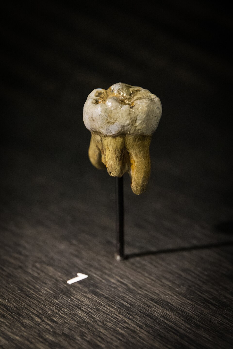 #6 - The Teeth That Looked Impossibly Ancient