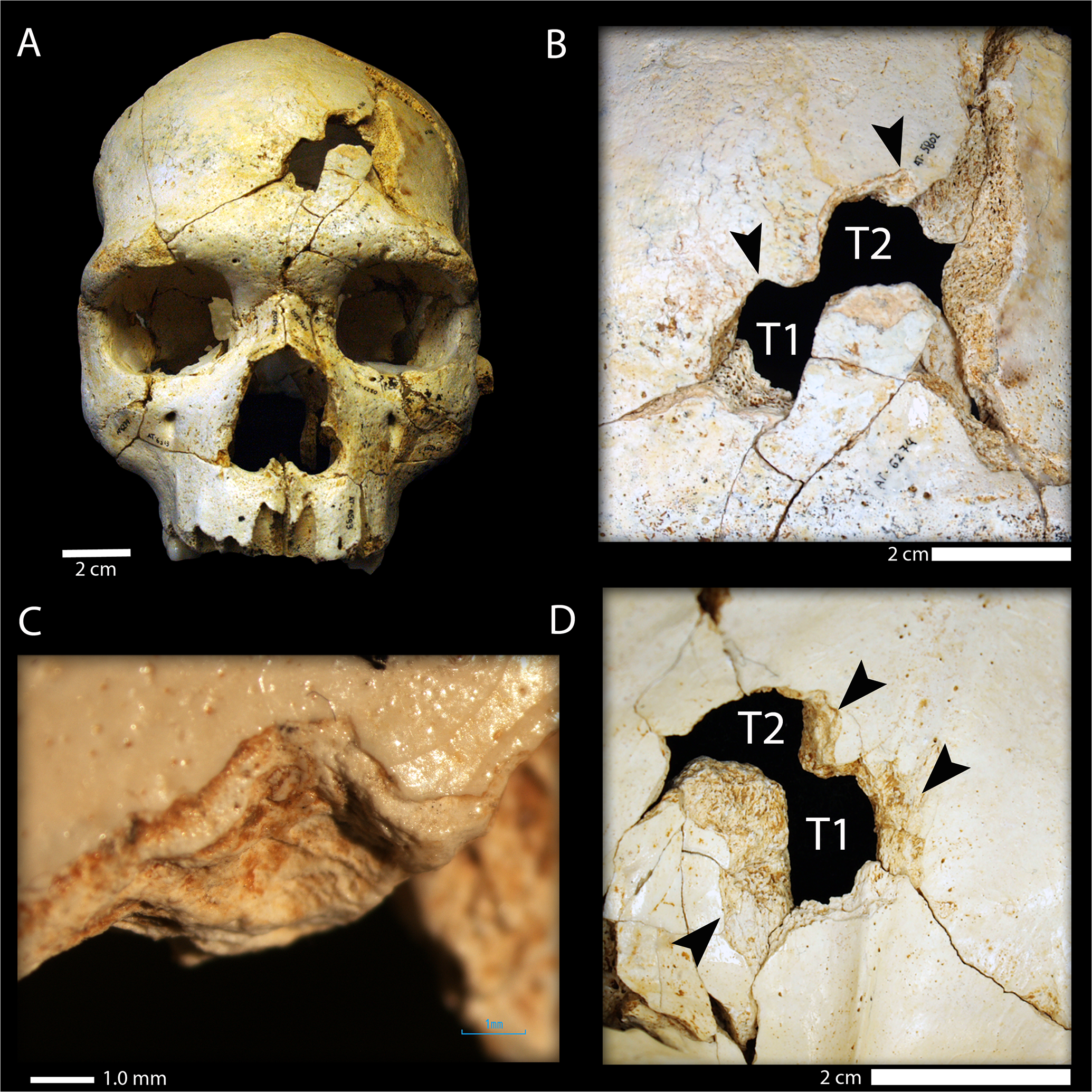 #1 - Cranium 17, The 430,000-Year-Old Murder Victim